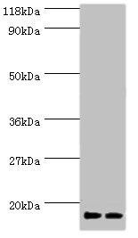 RPS19 Antibody (PACO26161)