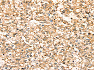 SLC25A38 Antibody (PACO20491)