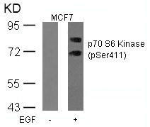 Phospho-RPS6KB1 (Ser411) Antibody (PACO24496)