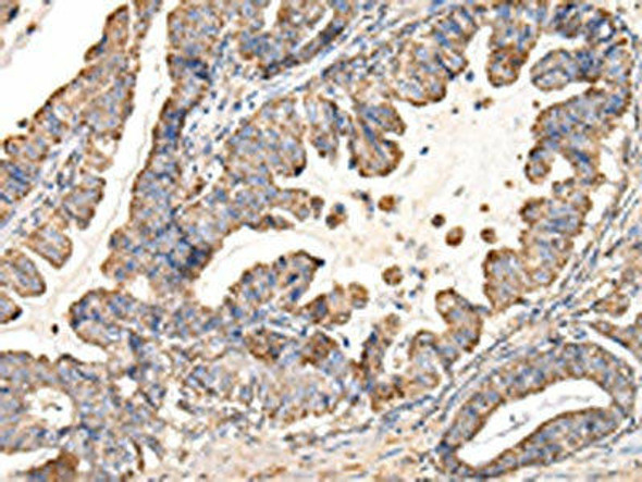 UQCRC1 Antibody (PACO17387)