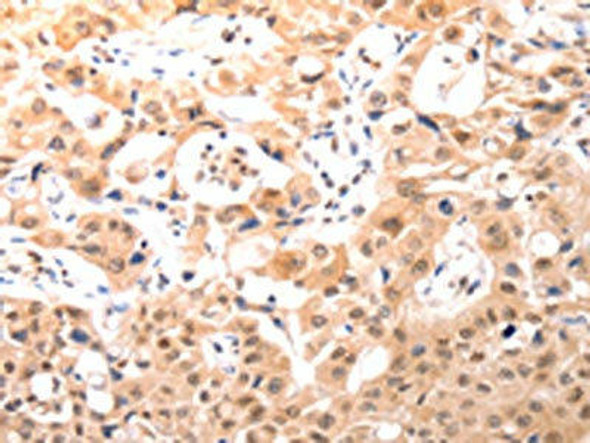 BDKRB2 Antibody (PACO17621)