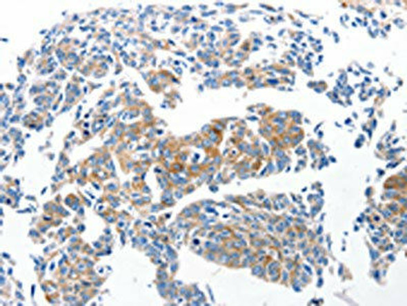 Ccl6 Antibody (PACO17660)