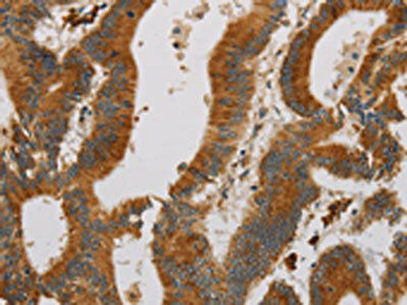 CCR8 Antibody (PACO17673)