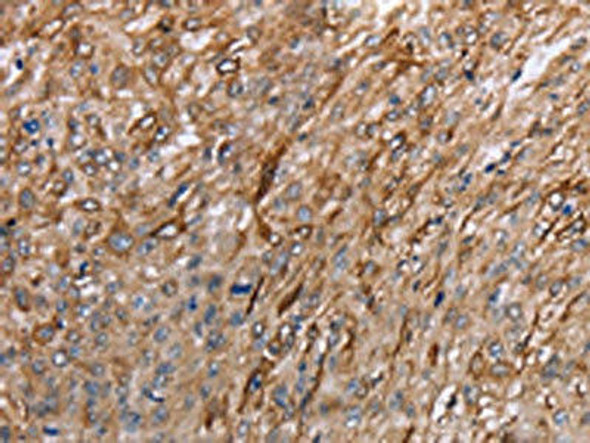 GRPR Antibody (PACO17931)