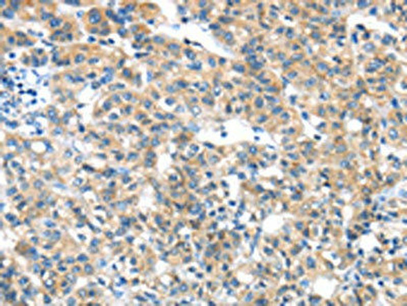 GZMK Antibody (PACO18016)