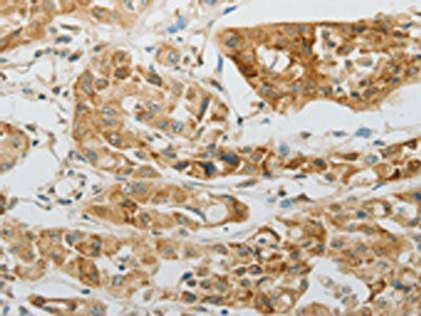 LEPR Antibody (PACO18147)