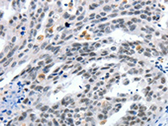 LRP5 Antibody (PACO18168)