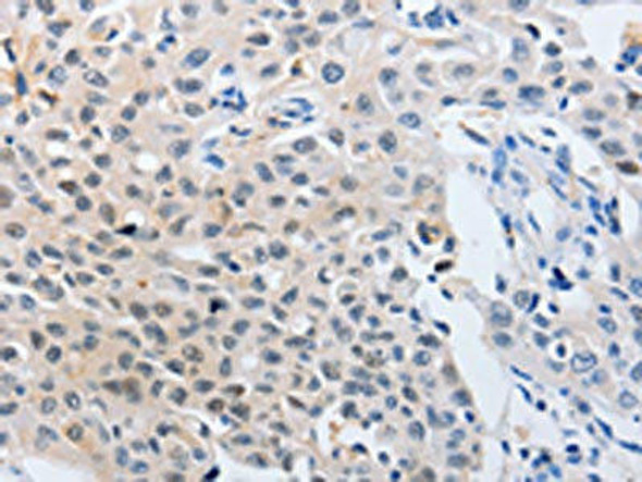 YWHAQ Antibody (PACO18271)