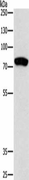 PRKCB Antibody (PACO19184)