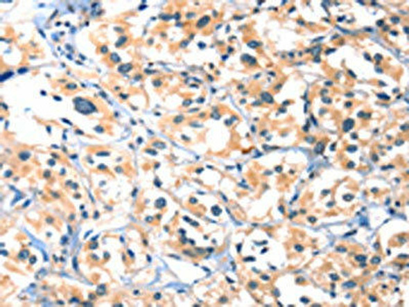 HTR3B Antibody (PACO19263)