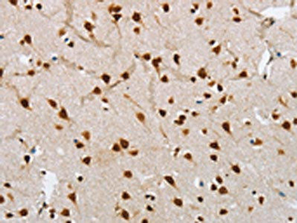 NLRP7 Antibody (PACO19306)