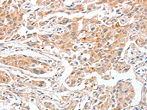 ABO Antibody (PACO19354)