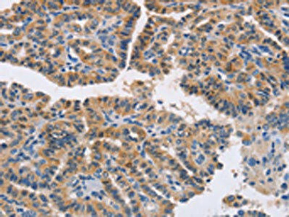 NCR1 Antibody (PACO19415)