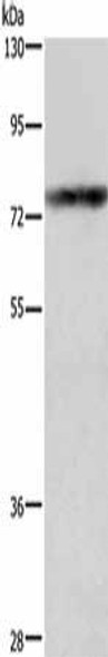 GALC Antibody (PACO19692)
