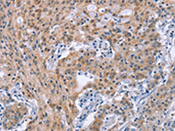 GNPAT Antibody (PACO19726)