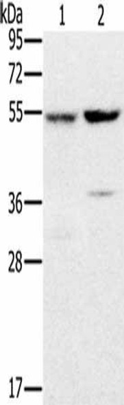 PPM1F Antibody (PACO20268)