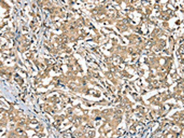 SGPL1 Antibody (PACO20453)