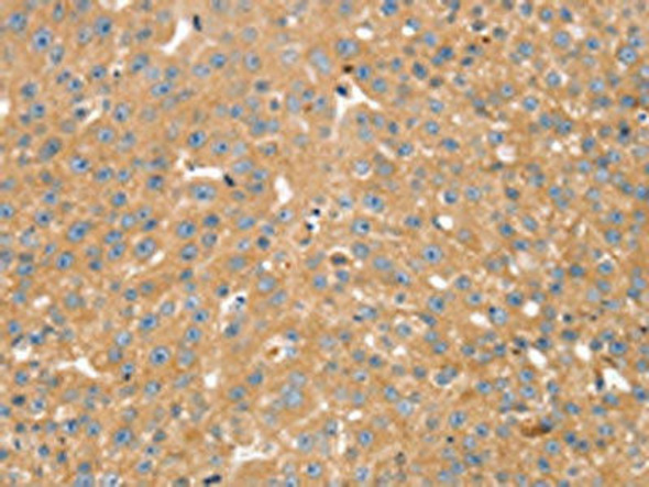 SNX2 Antibody (PACO20566)