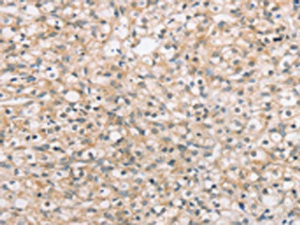 ROR1 Antibody (PACO20580)