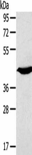 KCNK3 Antibody (PACO20658)
