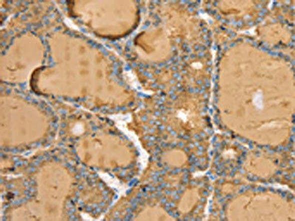 TG Antibody (PACO20669)