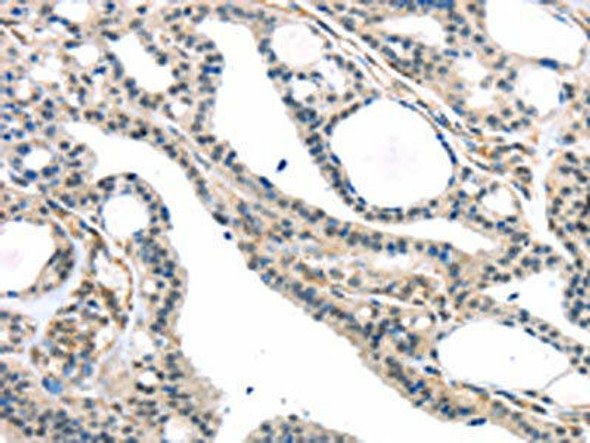 KDM5C Antibody (PACO20825)