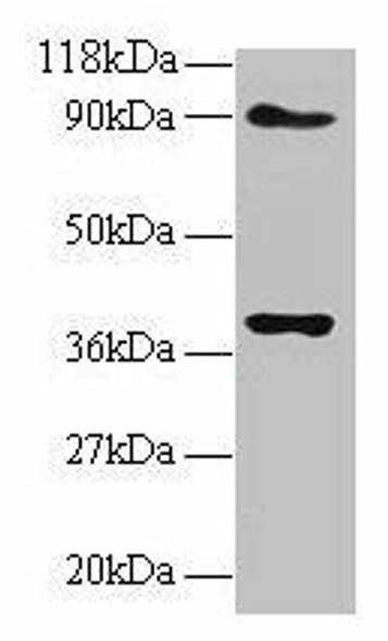NDUFS5 Antibody (PACO31540)