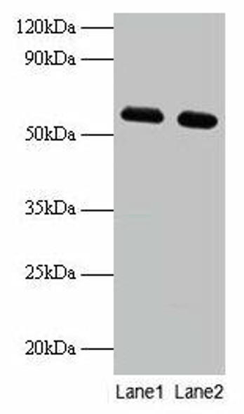 PHGDH Antibody (PACO31644)