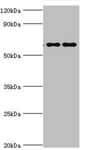 FUBP3 Antibody (PACO43597)