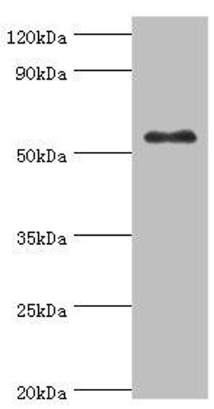 GCK Antibody (PACO43605)