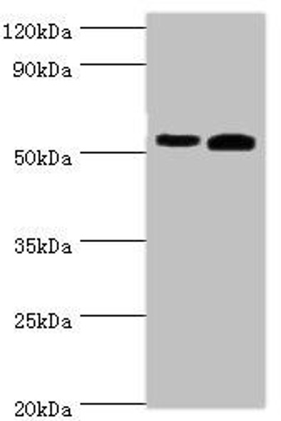 ALDH1A2 Antibody (PACO43624)