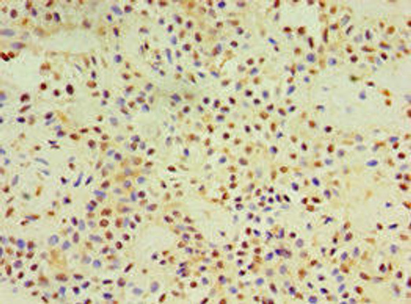 DACT3 Antibody (PACO43724)