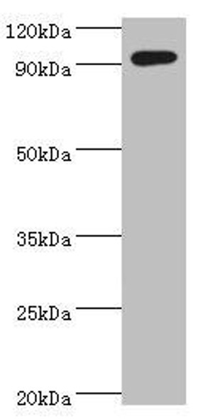 SEMA4C Antibody (PACO43832)