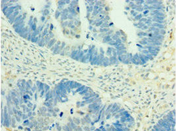 MEF2C Antibody (PACO43903)