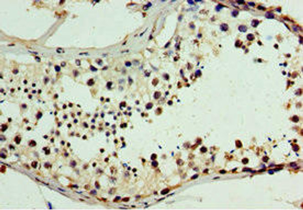CHD2 Antibody (PACO43947)