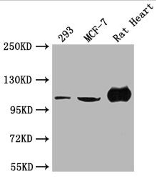ACTN2 Antibody (PACO64127)