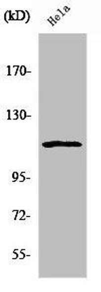 NFATC3 Antibody (PACO01168)