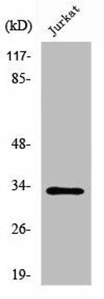 UCP3 Antibody (PACO01677)