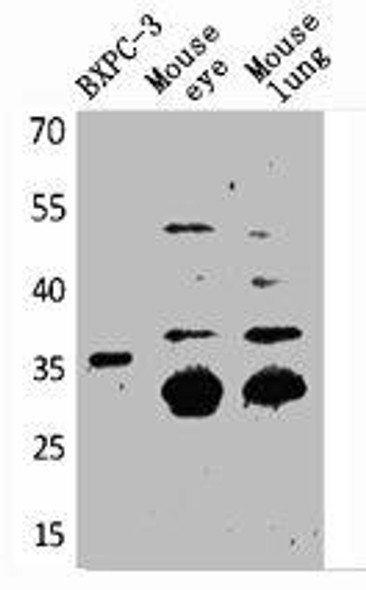 F3 Antibody (PACO01907)