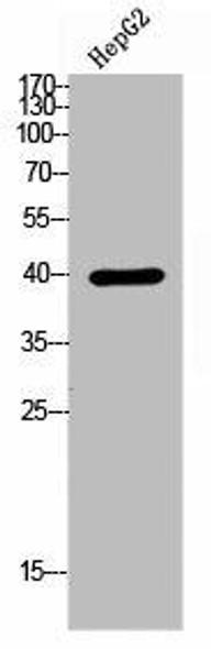 RSAD2 Antibody (PACO02201)