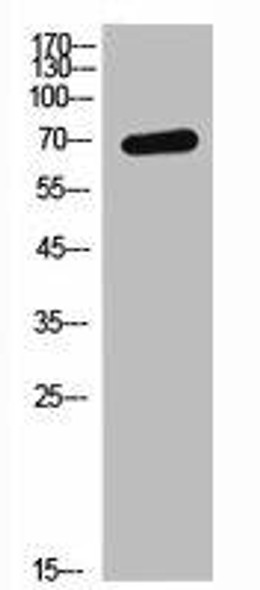 GHR Antibody (PACO02238)