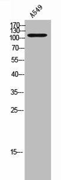 TNK2 Antibody (PACO02302)