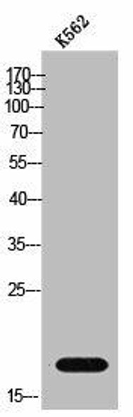 GUSBP1 Antibody (PACO02531)