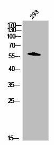 LCK Antibody (PACO02867)