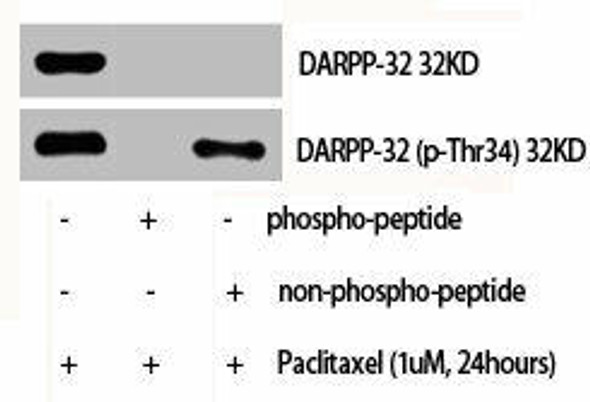 PPP1R1B Antibody (PACO06421)