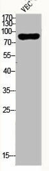 DYRK1A Antibody (PACO06441)