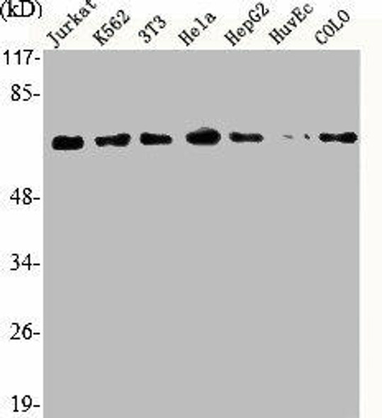 GRK5 Antibody (PACO06531)