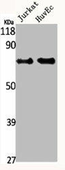 IRAK2 Antibody (PACO06591)