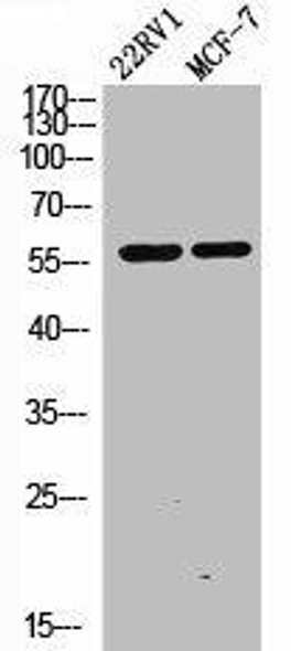 MAOA Antibody (PACO06624)