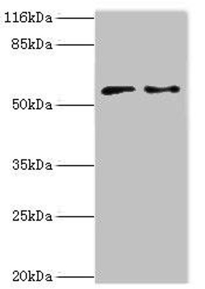 CRISPLD2 Antibody (PACO41890)